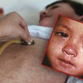 Nemanja je opasan virus dobio sa 6 meseci, oporavio se, ali 3 godine kasnije kreću zastrašujući simptomi: Majka objasnila kroz…