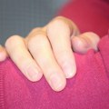 Linije na noktima mogu ukazivati na potencijalne zdravstvene probleme