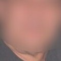 Ubio invalida udarcima šipkom po glavi Po hašenju sud mu je odredio pritvor