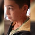 (Video) Nikolu majka polila kiselinom, pa skočila sa njim sa 3. sprata Jeziva sudbina dečaka potresla Srbiju: Čudom preživeo…