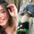 Pojela supu i ostala paralizovana: Šta se krilo u konzervi koja je devojku prikovala za respirator