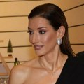 Jovana Joksimović bolest prikriva šminkom, ali nije jedina, i ova poznata dama to čini FOTO