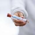 Španija: Zdravstvene upozorile na lažne testove za KOVID i grip na evropskom tržištu