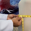 Gojenje u određenim godinama povećava rizik od nekoliko vrsta raka: kada je debljanje najopasnije za žene, a kada za muškarce…