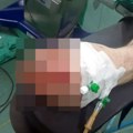 Direktor Kliničkog centra o stanju Dragiše Galjka: "Zbog teške povrede mu predstoji ozbiljno lečenje"
