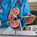 Naučnici stvorili "univerzalni bubreg": Moći će da ga prihvati svaki paijent