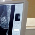 Besplatni pregledi dojke i prostate u nedelju