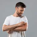 Ako imate problem, javite se dermatologu što pre: Efikasne terapije za psorijazu postoje u Srbiji