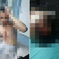 Određen pritvor nasilniku koji je kaišem pretukao tinejdžera: Oglasilo se tužilaštvo u Smederevu zbog jezivog zločina