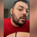 Sloba Vasić imao 150 KG, pa ugradio balon u stomak: Pevač odustao od operacije želuca, pa ovako uspeo da se prepolovi
