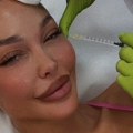 Maja Marinković otišla na "remont": Pokazala kom estetskom zahvatu se ponovo podvrgla