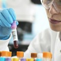 Медицина и Велика Британија: Тест крви за 50 врста канцера охрабрио научнике