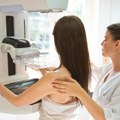 Akcija mamografskih pregleda tokom maja Dopunski termini za pregled žena od 40 do 50 godina