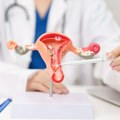Više od 4.000 žena godišnje dobije dijagnozu ginekološkog karcinoma: Savremene terapije nisu svima dostupne