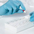 Engleska na putu da eliminše hepatitis C