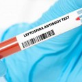 Registrovan prvi slučaj leptospiroze: Zarazna bolest potvrđena u Bijelom Polju