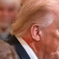 Da li to Tramp ima herpes zoster? Čudna mrlja na vratu predsednika SAD