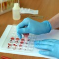 Нови тест крви могао би да предвиди болести и до 10 година унапред