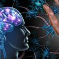 15 neuroloških autoimunih bolesti za koje treba da znate: Multipla skleroza je samo jedna od njih