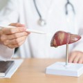 Pet suptilnih znakova koji ukazuju na oštećenje jetre
