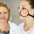 Осип није увек само проблем коже: Реуматолог упозорава на знакове аутоимунских болести