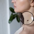 Svetski dan borbe protiv melanoma – jedan pregled godišnje može spasiti život.