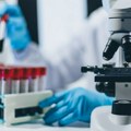 Sad odlučile da ukinu finansiranje istraživanja vakcine protiv HIV: Ugrožen važan projekat u Južnoj Africi