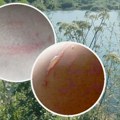 (Foto) nova "biljka ubica" otkrivena u Srbiji: Lozničanka ju je samo dotakla i dobila jezive ožiljke, od nje može i da se…