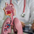 Klinička slika nastupa iznenada za nekoliko minuta: Prepoznajte opaku bolest od koje i sportisti obolevaju
