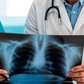 Истина која стоји иза седам уобичајених митова о раку плућа