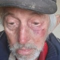 Deda Radovan (84) iz Koraćice došao u bolnicu u Beograd, pa nestao