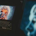 Kad AI kaže "slažem se s tobom": Zašto chatbot i veštačka inteligencija nisu zamena za psihoterapeuta (VIDEO)