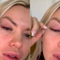 Crveno i otečeno oko! Naša rijaliti učesnica objavila uznemirujući snimak: "Mnogo me boli" (foto)