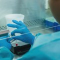 NHS: Engleska na putu da eliminiše hepatitis C