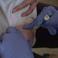 Skoro svi oboleli od morbila – nevakcinisani