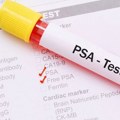 Rak prostate ne boli, ali ubija: Dve nedelje besplatnog PSA testiranja u Beogradu