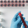 Novi test krvi otkriva više od 50 vrsta raka pre pojave simptoma