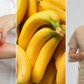 Banane mogu biti izuzetno rizične ako bolujete od određenih bolesti Alergije, astma, dermatitis, sindrom iritabilnog creva…