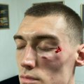 Naneli udario pesnicom u lice košarkaša Zvezde – novi skandal na dan trećeg meča finala ABA lige