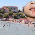 Na hrvatskim plažama pojavila se zaraza „slatke kraste“: Doktorka kaže da se lako širi