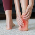 Psorijatični artritis često prvo napada stopala: Znaci da se bore sa upalom, koja tiho oduzima pokretljivost