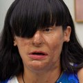 Bivši je posle raskida polio kiselinom i unakazio joj lice - ona se nakon što je izašao iz zatvora u tajnosti udala za njega…
