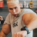 "Руски Попај" могао би да остане без обе руке: Момку који је себи убризгавао петролеј како би имао огромне бицепсе, прети…