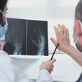 Osteoartitis i uticaj testosterona: Novo otkriće Univerziteta u Vuhanu