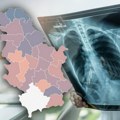 "Ukoliko ovo radite godinama, možda imate rak pluća": Naš onkolog otkrio alarmantne podatke: Oboljevaju mladi, cigare nisu…