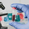 Revolucija u medicini: Univerzalna veštačka krv sa rokom trajanja do dve godine