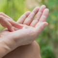 Kako prepoznati da li ste dehidrirali? Lekar otkrio jednostavan trik sa rukama, pomaže da prepoznate problem