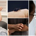 Ujed insekta izgleda bezazleno, ali može da napravi haos! Evo kako da prepoznate kritičan trenutak i spasite sebe ili druge