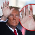 FOTO Šta se dešava sa Trampom? Bivši predsednik SAD uslikan sa „čudnim mrljama“ na rukama