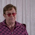 Elton Džon se bori sa infekcijom: Ograničen mu vid na jednom oku: "Leto provodim oporavljajući se kod kuće"